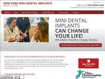 nyminidentalimplants.com