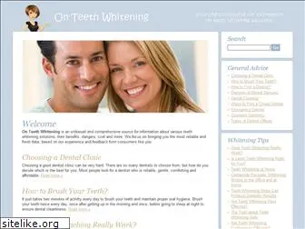 onteethwhitening.com