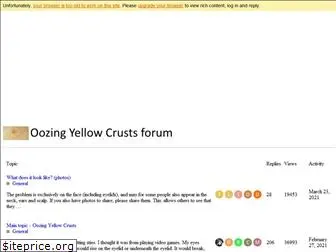 oozingyellowcrusts.com