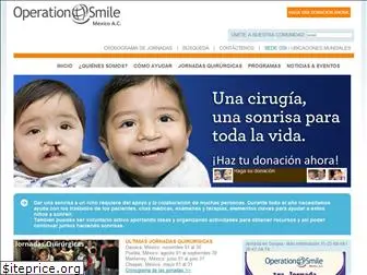 operationsmile.org.mx