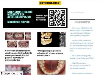 orthohacker.com