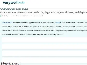 osteoarthritis.about.com