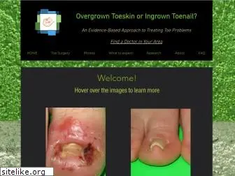 overgrowntoeskin.ca