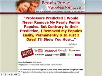 pearlypapulesremoval.net