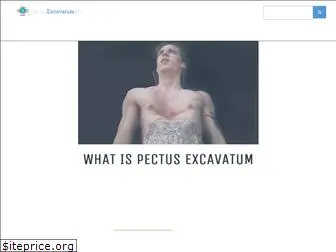 pectusexcavatumfix.com