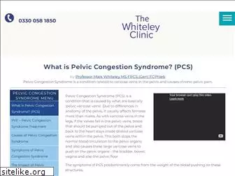 pelvic-congestion-syndrome.co.uk