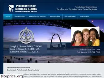 periodonticsofsouthernillinois.com