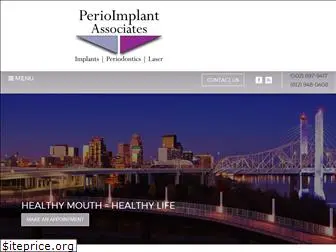 perioimplantassociates.com