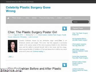 plastic-surgery-implants.com