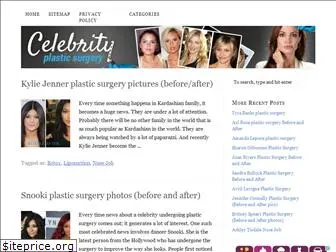 plasticsurgerykpop.com