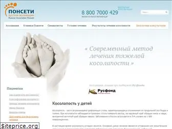 ponseti.ru