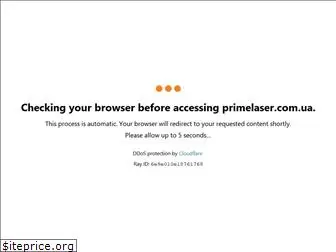 primelaser.com.ua