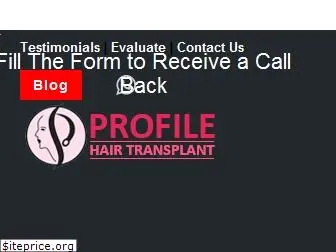 profilehaircentre.in