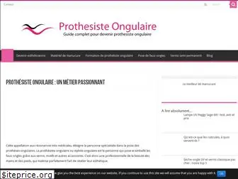 prothesisteongulaire.net
