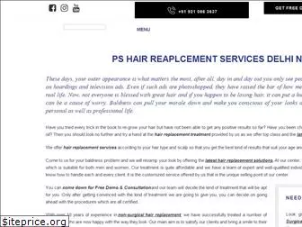 pshairreplacement.com