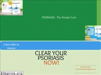 psoriasis-thesimplecure.com