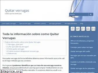 quitarverrugas.com