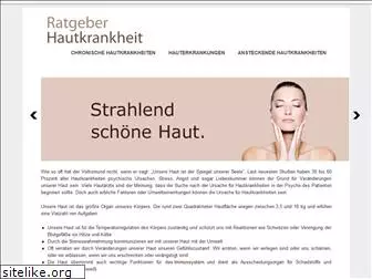 ratgeber-hautkrankheit.de