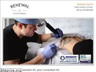 renewaltattooremoval.com