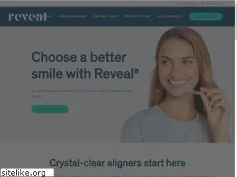 revealclearaligners.com