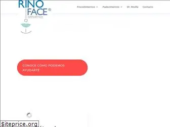 rinoface.com.mx