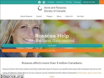 rosaceahelp.ca