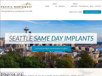 samedayimplants.com