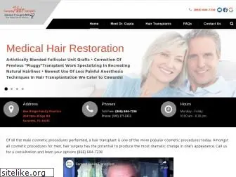 sarasotahairtransplant.com