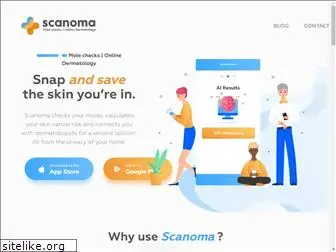 scanoma.com