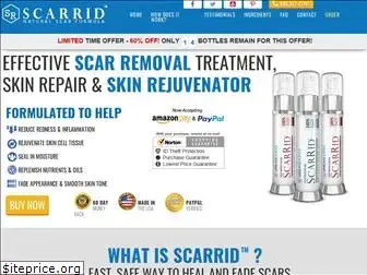 scarrid.com