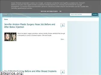 scplasticsurgery.blogspot.com