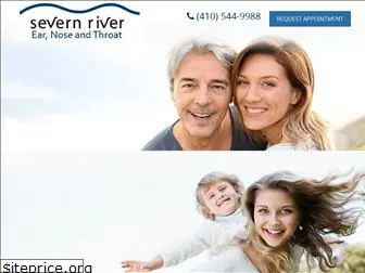 severnriverent.com