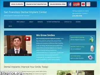 sfdentalimplants.com