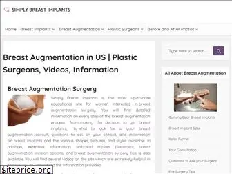 simplybreastimplants.com