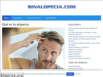 sinalopecia.com