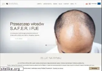 skin-laser.pl