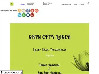 skincitylaser.com