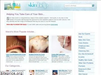 skinhelp.co.uk