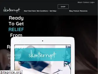 skinterrupt.com
