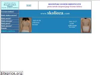 skolioza.com