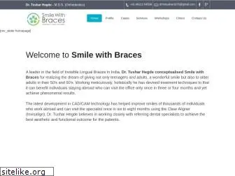 smilewithbraces.in