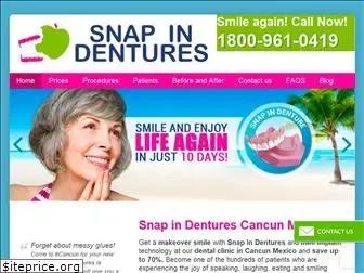 snapindentures.dental