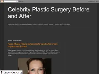 splasticsurgery.blogspot.com