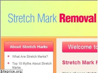 stretchmarkremoval.com