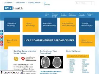 stroke.ucla.edu