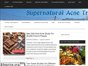 supernaturalacnetreatment.com