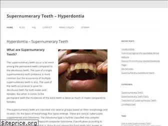 supernumeraryteeth.com