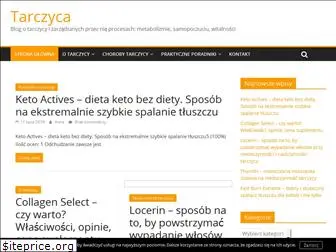 tarczyca.net.pl