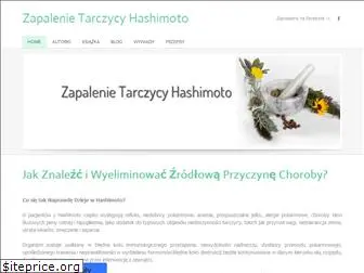 tarczycahashimoto.pl