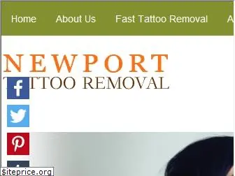 tattooremoval.co